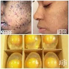 Savon gommant éclaircissant et exfoliant aux œufs et collagène ultra protéiné – Image 3